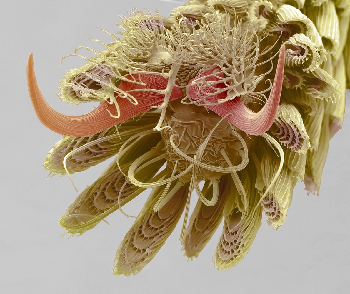 Name:  A mosquitos foot at 800X magnification.jpg
Views: 639
Size:  216.9 KB